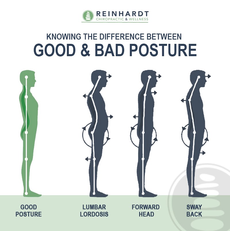 Bad posture: Can chiropractic care reverse bad posture?
